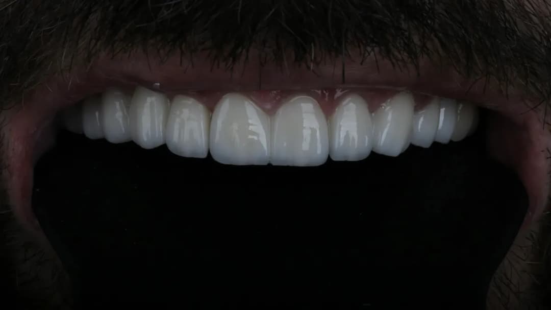 Taksim Dental Clinic — Dental Clinics in Istanbul