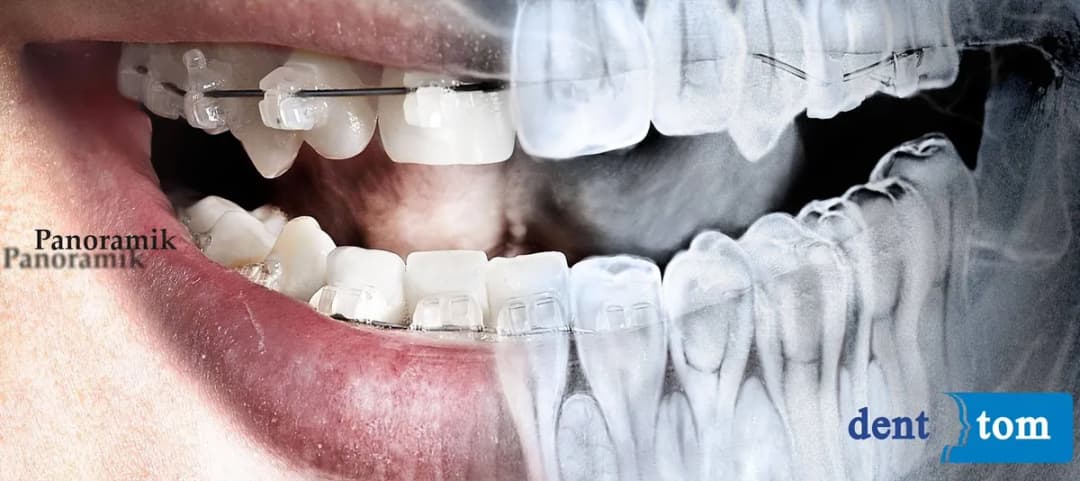 Denttom Dental Görüntüleme Merkezi (diş tomografisi - Panoramik Röntgen) — Radiology & Imaging in Istanbul