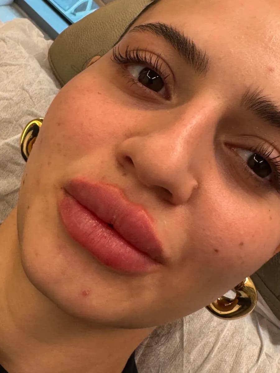 Dr. Şule Şakrak Beauty Clinic /Sculptura / عيادة البوتوكس في اسطنبول/ Nucleofill/ SıvıYüzGerme/ MineralDolgu/ VeganDolgu — Dermatology & Skin Care in Istanbul