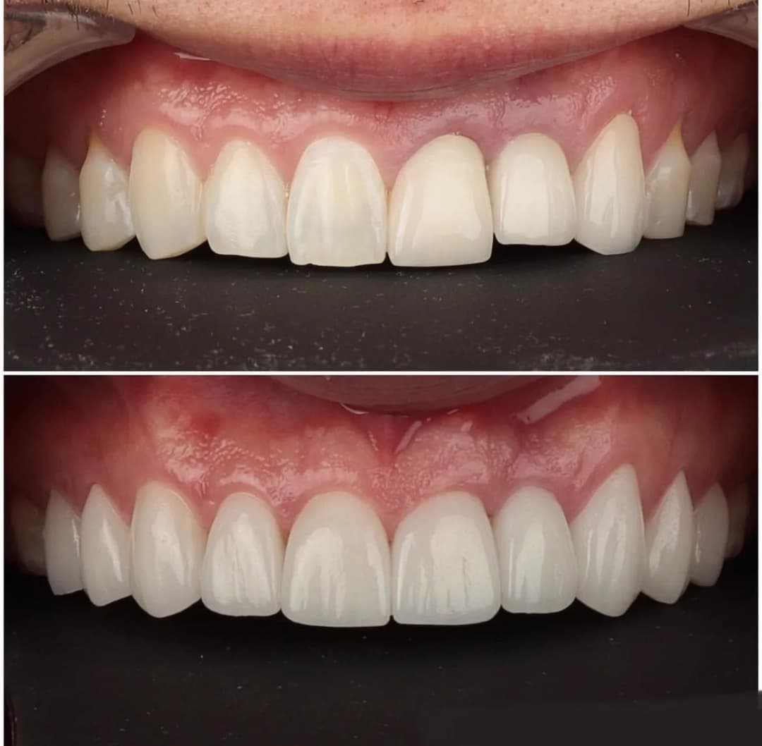 Denta May Clinic — Dental Clinics in Istanbul
