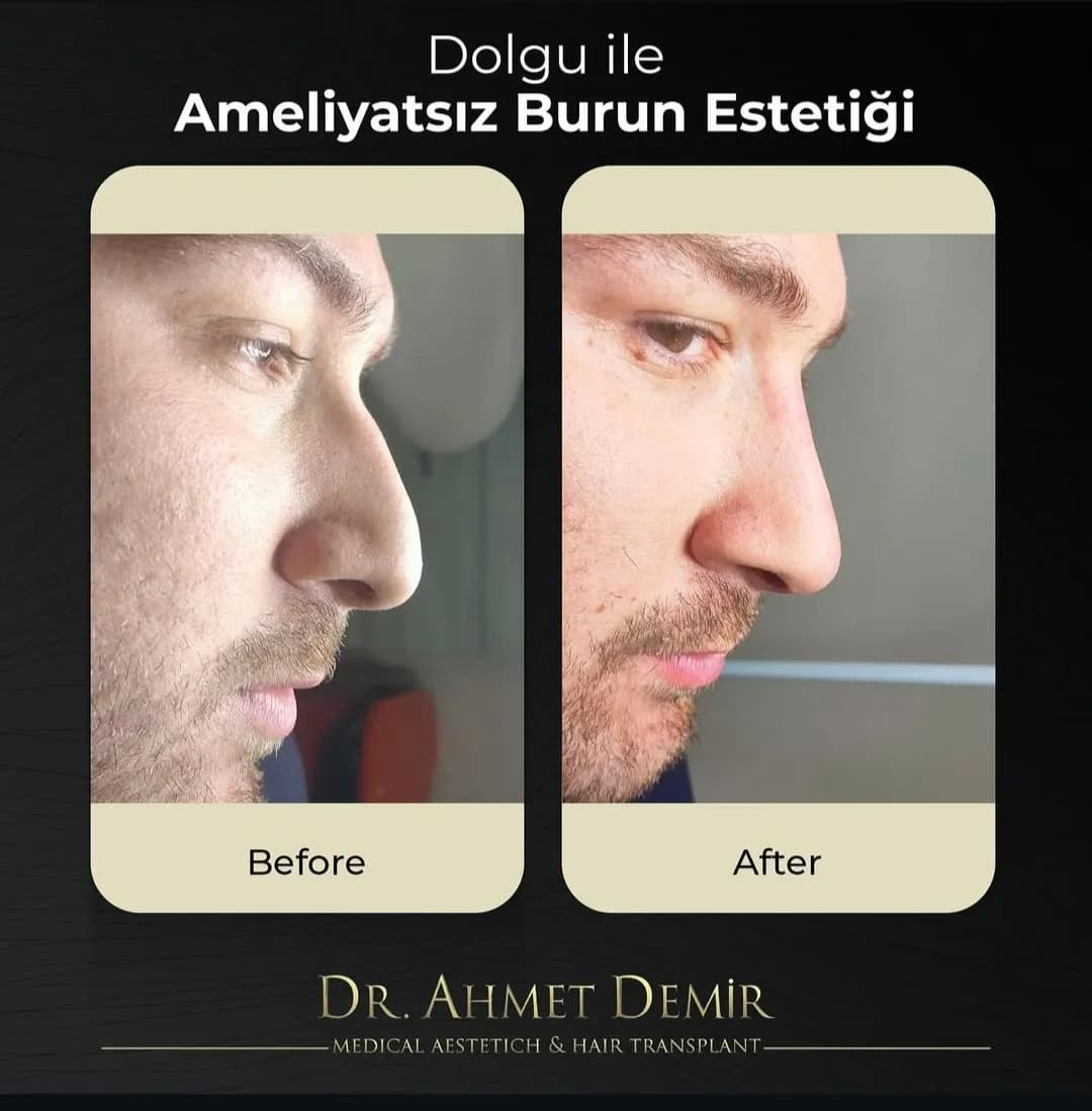 İstanbul Estetik ve Saç Merkezi / İstanbul Aesthetic and Hair Center — Alternative & Holistic Medicine in Istanbul