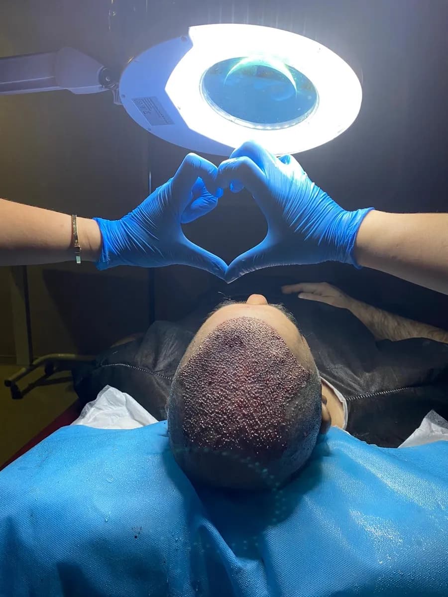 DHI hair transplant - Best Hair Transplant In Istanbul - Hair Transplant Clinic In Turkey - FUE hair transplant — Dermatology & Skin Care in Istanbul
