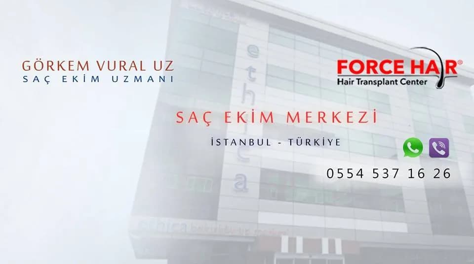 Hair Transplantation | Force Hair Center — Dermatology & Skin Care in Istanbul