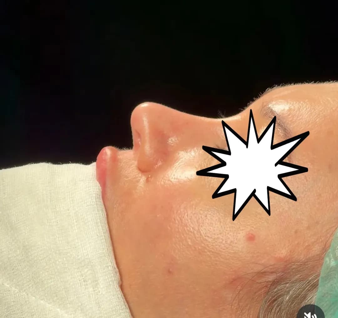 Prof. Dr. Fahrettin Yılmaz — ENT (Ear, Nose & Throat) in Istanbul